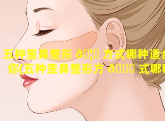 五种歪鼻整形 🦈 方式哪种适合你(五种歪鼻整形方 🐝 式哪种适合你的脸型)